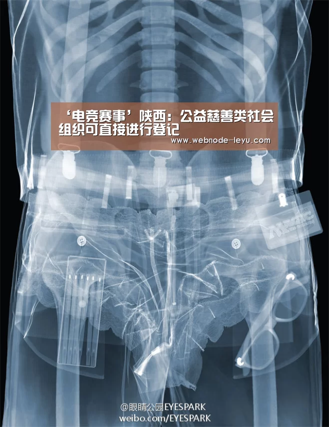 ‘电竞赛事’陕西:公益慈善类社会组织可直接进行登记(图2) 电竞赛事